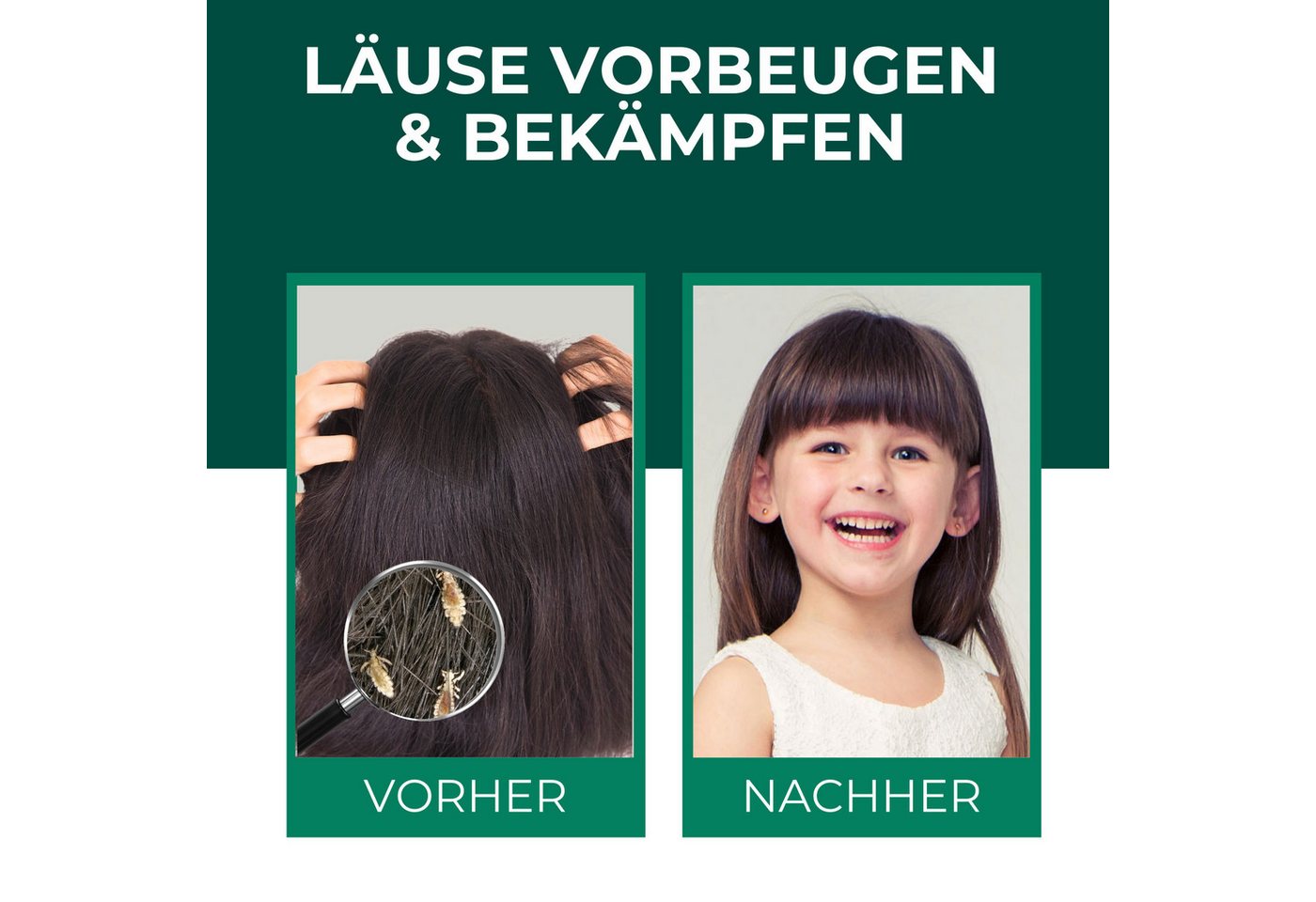 Silberkraft Insektenspray Silberkraft Kopfläusespray Effektiver Läuseschutz für Kopfhaut & Haare, 100.0 ml, 1-St., Läuse zuverlässig vorbeugen, Läuseabwehr für  – Bild 2 von 5