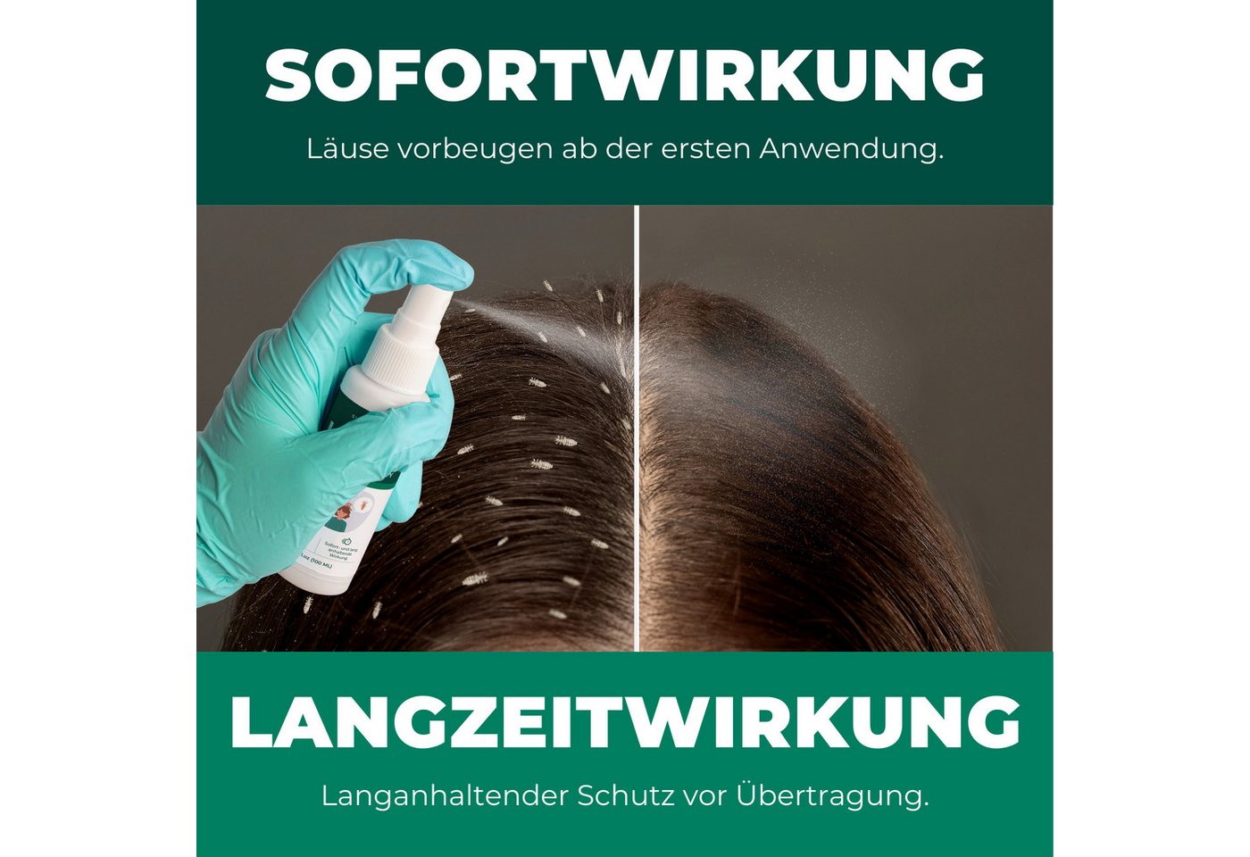 Silberkraft Insektenspray Silberkraft Kopfläusespray Effektiver Läuseschutz für Kopfhaut & Haare, 100.0 ml, 1-St., Läuse zuverlässig vorbeugen, Läuseabwehr für  – Bild 5 von 5